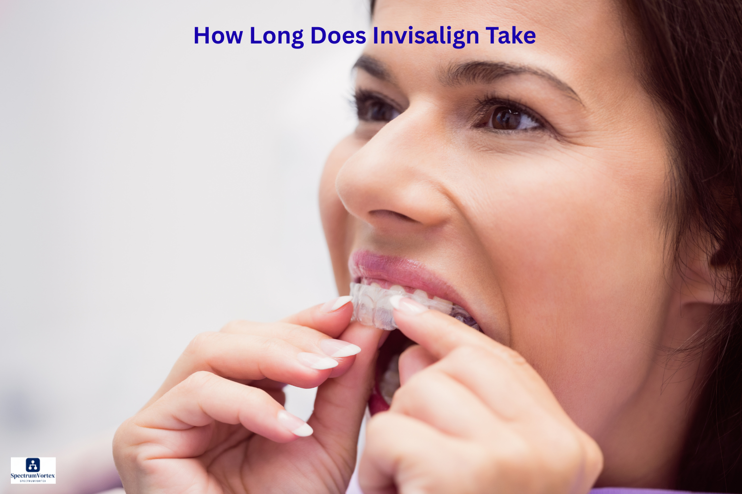 How Long Does Invisalign Take